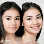 Cute Star Pimple & Acne Patches