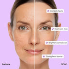 Marée® Tranexamic Dark Spot Corrector