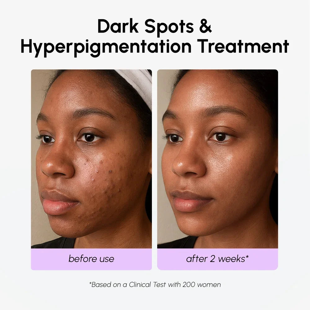 Marée® Tranexamic Dark Spot Corrector