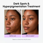 Marée® Tranexamic Dark Spot Corrector